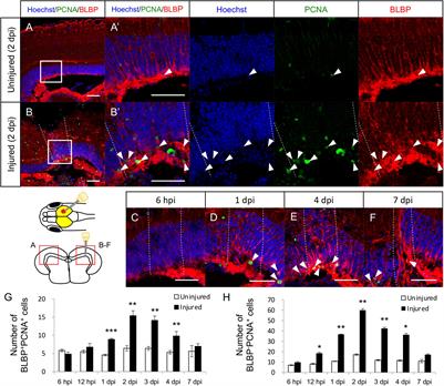 Differential Regenerative Capacity of the Optic Tectum of Adult Medaka and Zebrafish